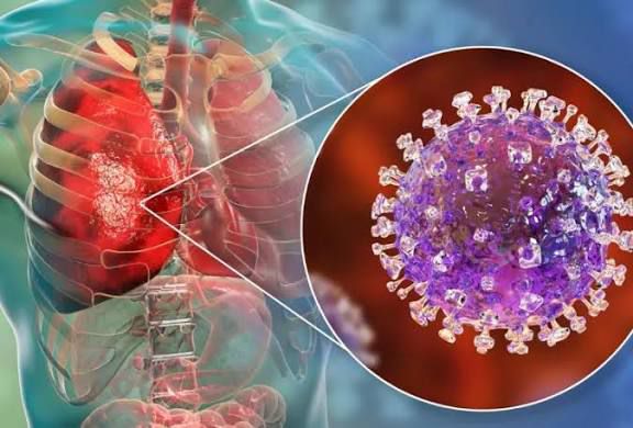 India confirma brote del virus Nipah.